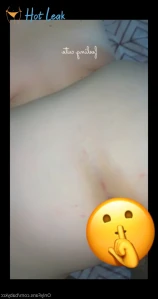 6642118