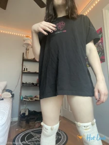 6299311