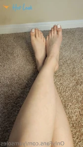11325281