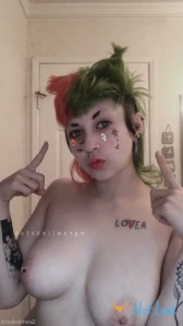 6625394