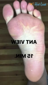 4811081