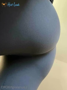 9587766