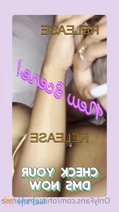 11139393