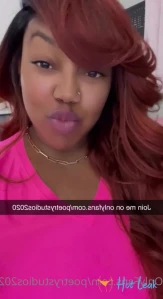 9164859