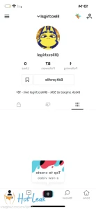 6613951