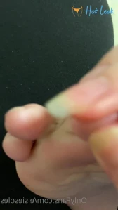 2555794