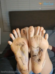 11254313