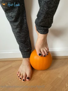 7684665
