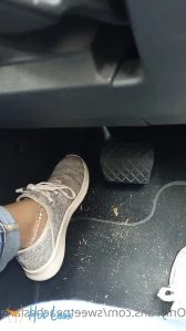 9121181