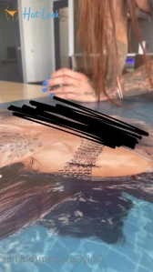 2871182