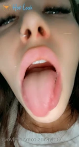4849581