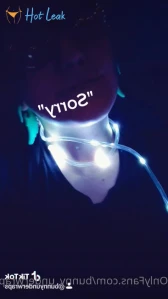 11400381