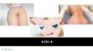 6236912