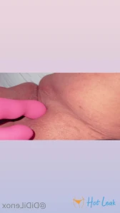 2954612