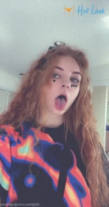6236253
