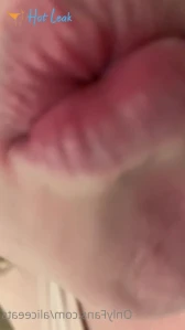 4855266