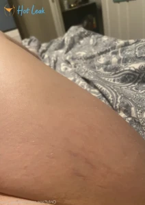 5849498