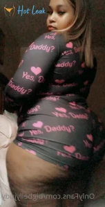 11392447
