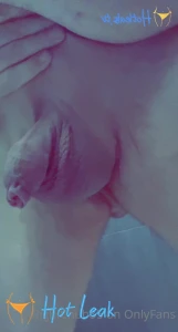 11866955