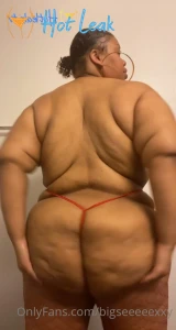 11587570