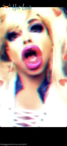 11398026