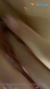3177170