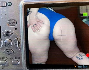 3623665
