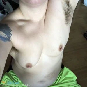 3628871