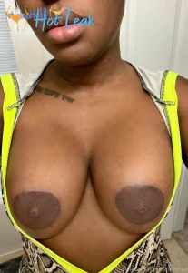 11931238