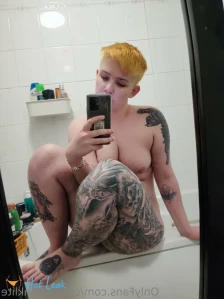 9545776