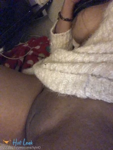 9977416