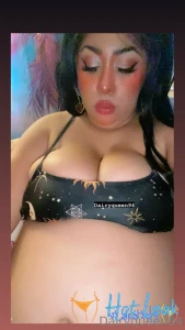 11837310