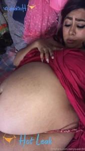 11851381
