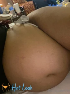 11857108