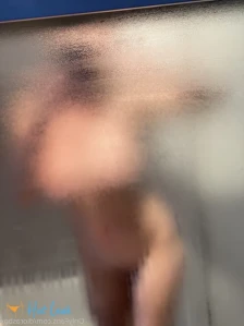 5872172