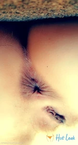 11044925