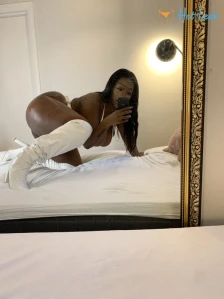 6323872