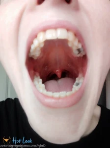 3366552