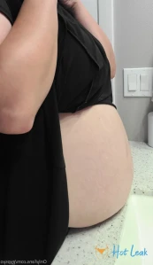 7751562