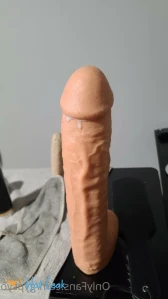 7751585