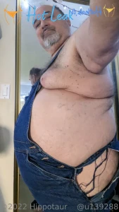 11449876