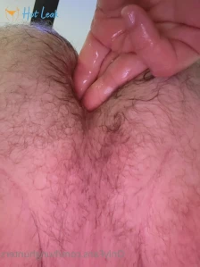9317783