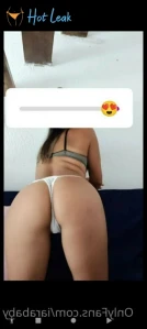 3155093