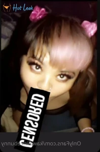 3476175