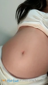 3975212