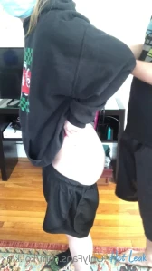 3981572