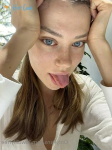5776723