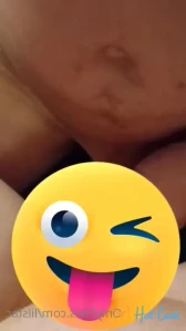 4118774
