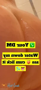 3118323