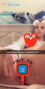 4179018